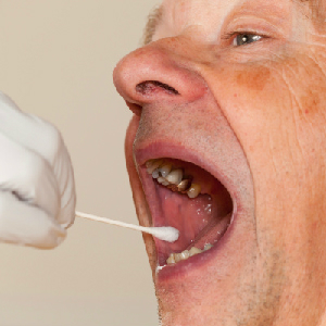 ACLU Says DNA Collection Violates Constitution