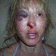 Female DUI Suspect Gets Face Smashed By Cops For Moving Too Slowly